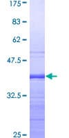 Human MECP2 Protein (Recombinant GST, N-terminus)