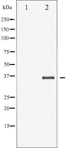 NFKBIB / IKB Beta / IKBB Antibody (phospho-Thr19)