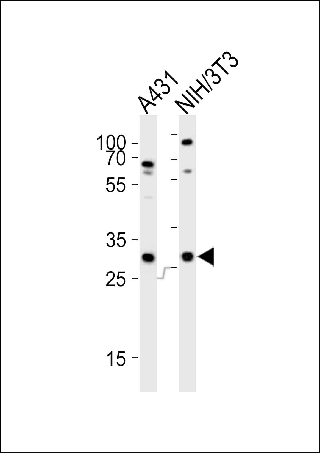 CDK5 Antibody (aa225-260)
