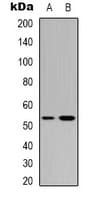 TP53 / p53 Antibody (C-Terminus)