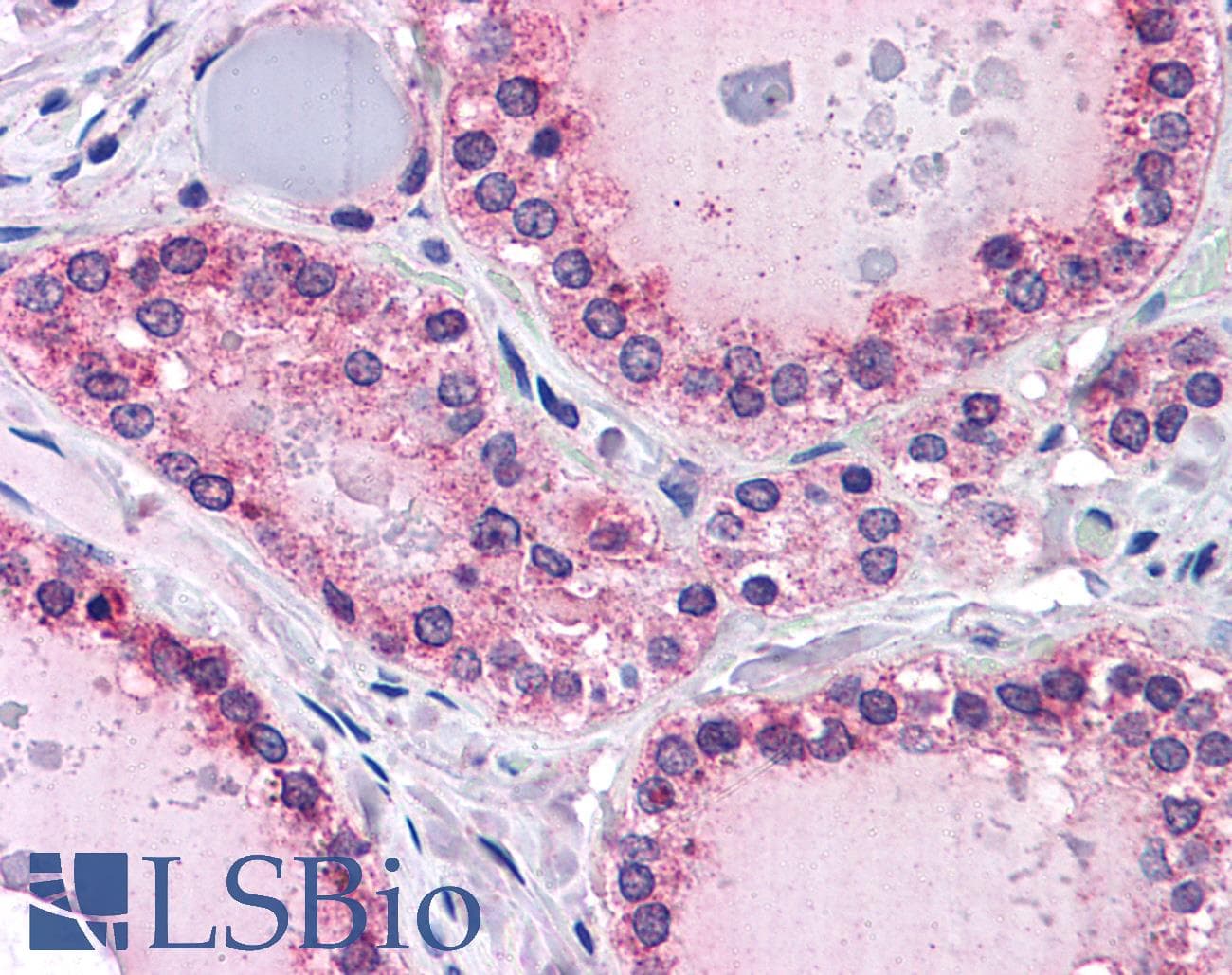 IHC-plus™ Polyclonal Goat anti-Human PTPRM / PTP Mu Antibody (aa1379-1392, IHC)