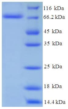 Human P450SCC / CYP11A1 Protein (Recombinant His-SUMO)