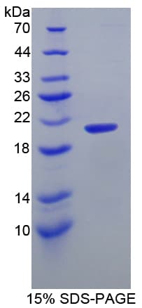 Human ITGA2B / CD41 Protein (Recombinant His-T7)