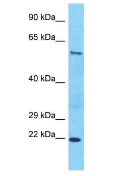 SLC43A2 Antibody (aa391-440)
