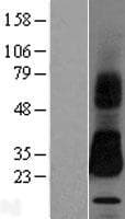 SPINT2 / HAI-2 Protein (Over-Expression Lysate Myc-DDK (Flag))