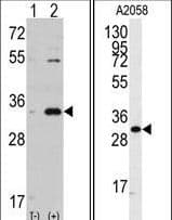 CDK1 / CDC2 Antibody (aa213-241)