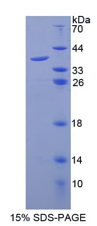 Bovine CXCL6 Protein (Recombinant His-GST, N-terminus)