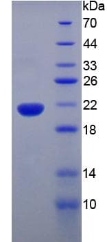 Mouse TNF Alpha Protein (Recombinant His, N-Terminal)