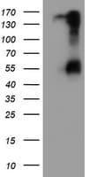 SPINT1 / HAI-1 Antibody (clone OTI4H2)
