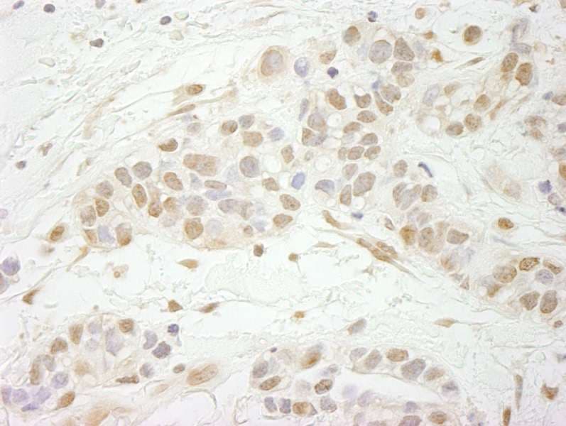 MTA3 Antibody (aa400-450)