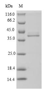 Neisseria meningitidis Penicillin-binding protein 1A (Recombinant 6His-SUMO, N-terminus)