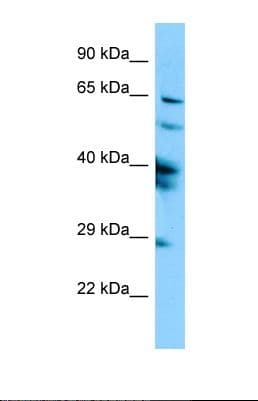 SPAG16 Antibody (aa160-209)