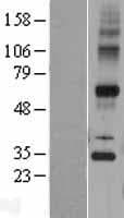 TECR / TER Protein (Over-Expression Lysate Myc-DDK (Flag))