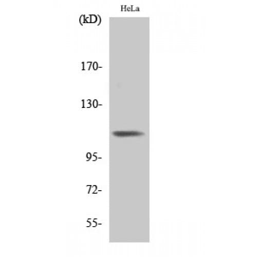 ITGB3 / Integrin Beta 3 / CD61 Antibody (720-800 aa)