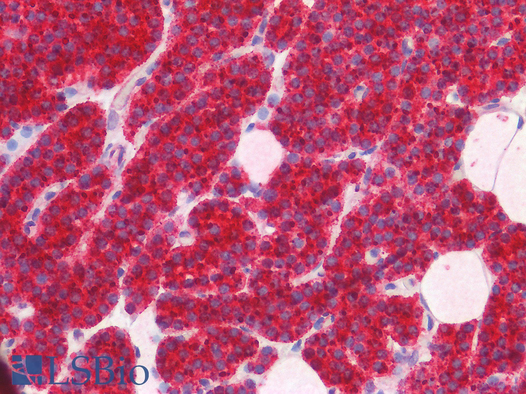 IHC-plus™ PTH / Parathyroid Hormone Antibody