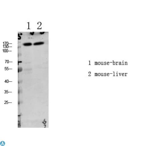 LATS1 Antibody