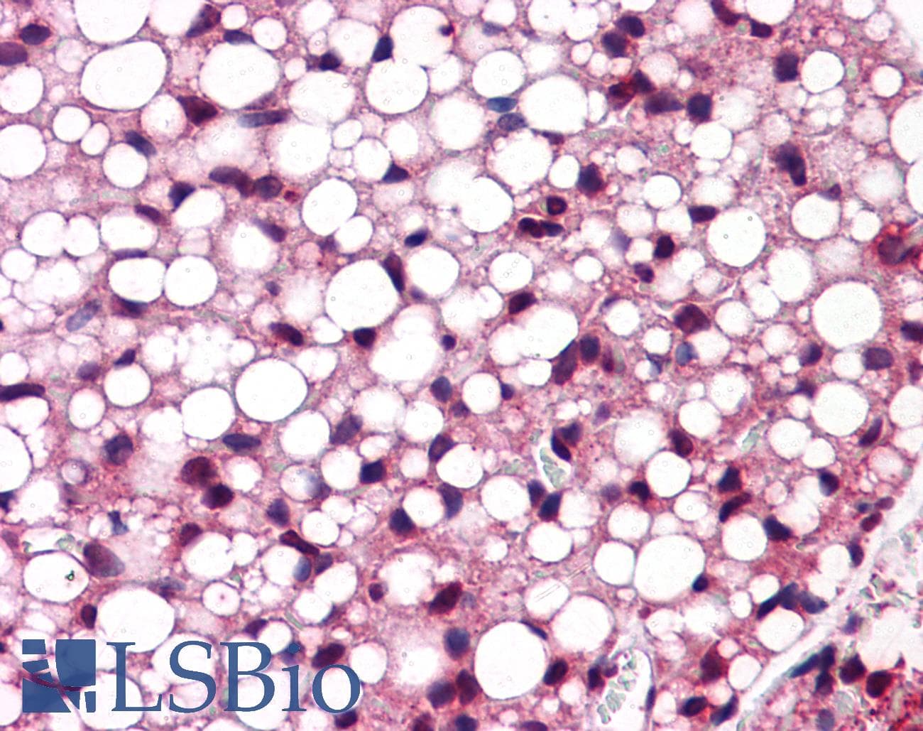 Polyclonal Rabbit anti-Mouse ATF6 Antibody (C-Terminus, IHC, WB)