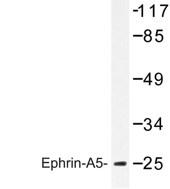 Polyclonal Rabbit anti-Human EFNA5 / Ephrin A5 Antibody (Pro63, IHC, IF, WB)