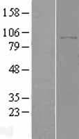 Dipeptidylpeptidase 8 / DPP8 Protein (Over-Expression Lysate Myc-DDK (Flag))