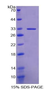 Human CD39 Protein (Recombinant His-T7)