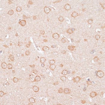 Polyclonal Rabbit anti-Human KCNJ4 / Kir2.3 Antibody (IHC, WB)