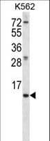 MEIG1 Antibody (aa36-65)