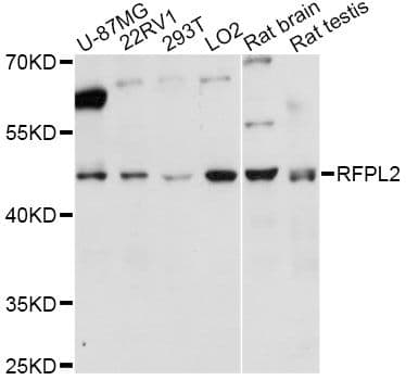Polyclonal Rabbit anti-Human RFPL2 Antibody (WB)