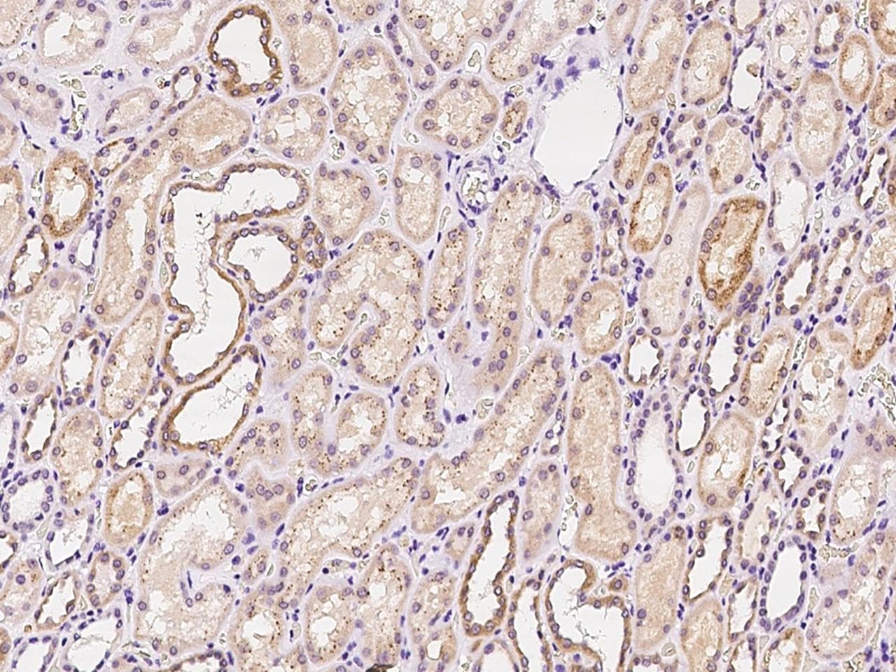 FAM46A Antibody