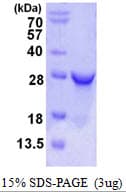 Human RPE Protein (Recombinant His)