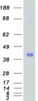 Human CAMK1 / CAMKI Protein (Recombinant Myc-DDK (Flag))