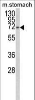 TCERG1L Antibody (aa392-421)