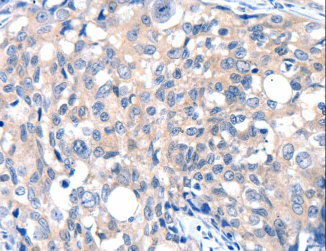 GRIN2D / NMDAR2D / NR2D Antibody