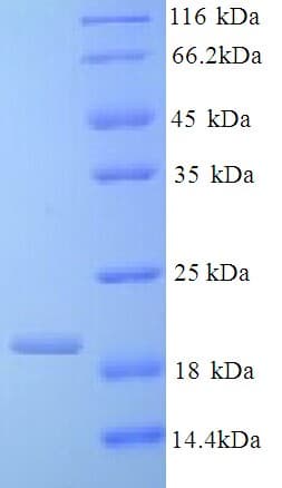 Bovine IL-10 Protein (Recombinant His)