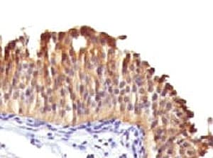 Monoclonal Mouse anti-Human KRT10 / CK10 / Cytokeratin 10 Antibody (clone DE-K10, Azide-free,BSA-free, IHC, IF)