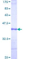 Human CFI / Complement Factor I Protein (Recombinant GST, N-terminus)