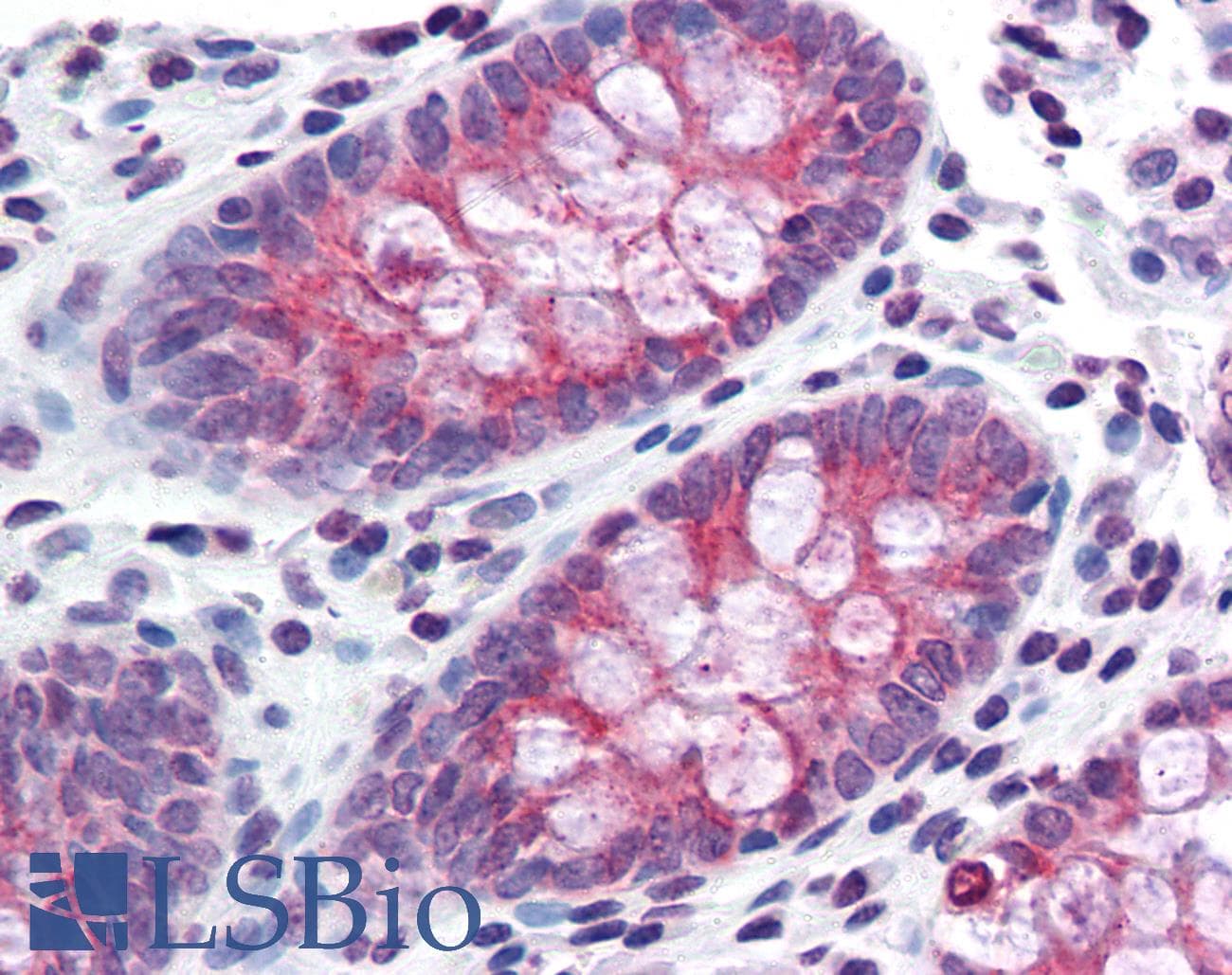 IHC-plus™ TMPRSS4 Antibody (Internal)