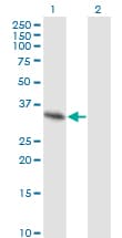 SPRY2 / Sprouty 2 Antibody (clone 1E10)