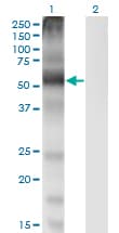 SLC7A1 / CAT1 Antibody (clone 2B9)
