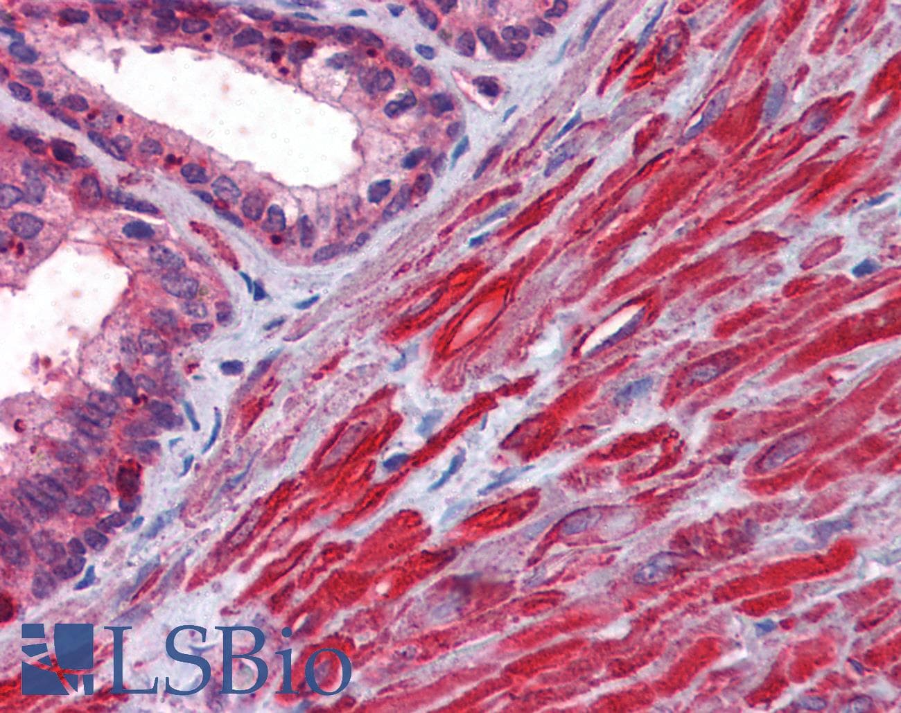 IHC-plus™ Polyclonal Rabbit anti-Human Fractin Antibody (C-Terminus, IHC, IF, WB)
