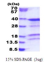 Human PRKRA / PACT Protein (Recombinant His)