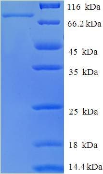 Human RORC / ROR Gamma Protein (Recombinant His-SUMO)