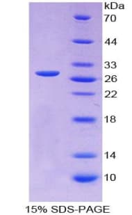 Rat MYOG / Myogenin Protein (Recombinant His-T7)