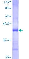 Human NRK Protein (Recombinant GST, N-terminus)