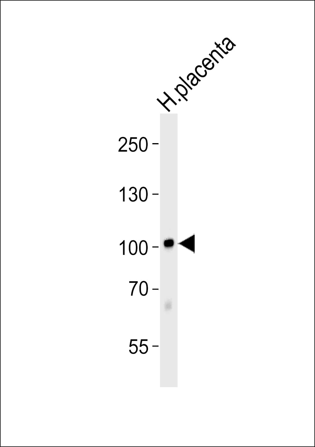 P3H1 / LEPRE1 Antibody (aa499-533)