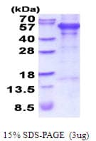 Human PCOLCE Protein (Recombinant His)