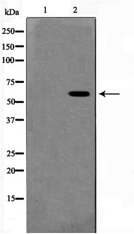 Polyclonal Rabbit anti-Human MAPK15 / ERK7 Antibody (phospho-Thr175/Tyr177, WB)