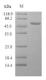 Mouse Properdin / CFP Protein (Recombinant 6His, N-terminus)