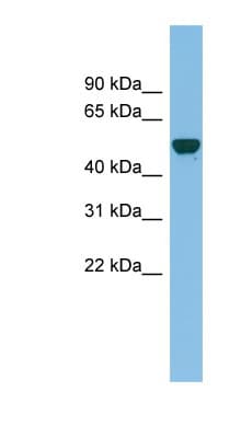 GDAP2 Antibody (aa107-156)