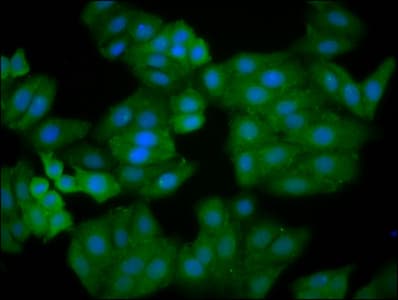 IQGAP2 Antibody