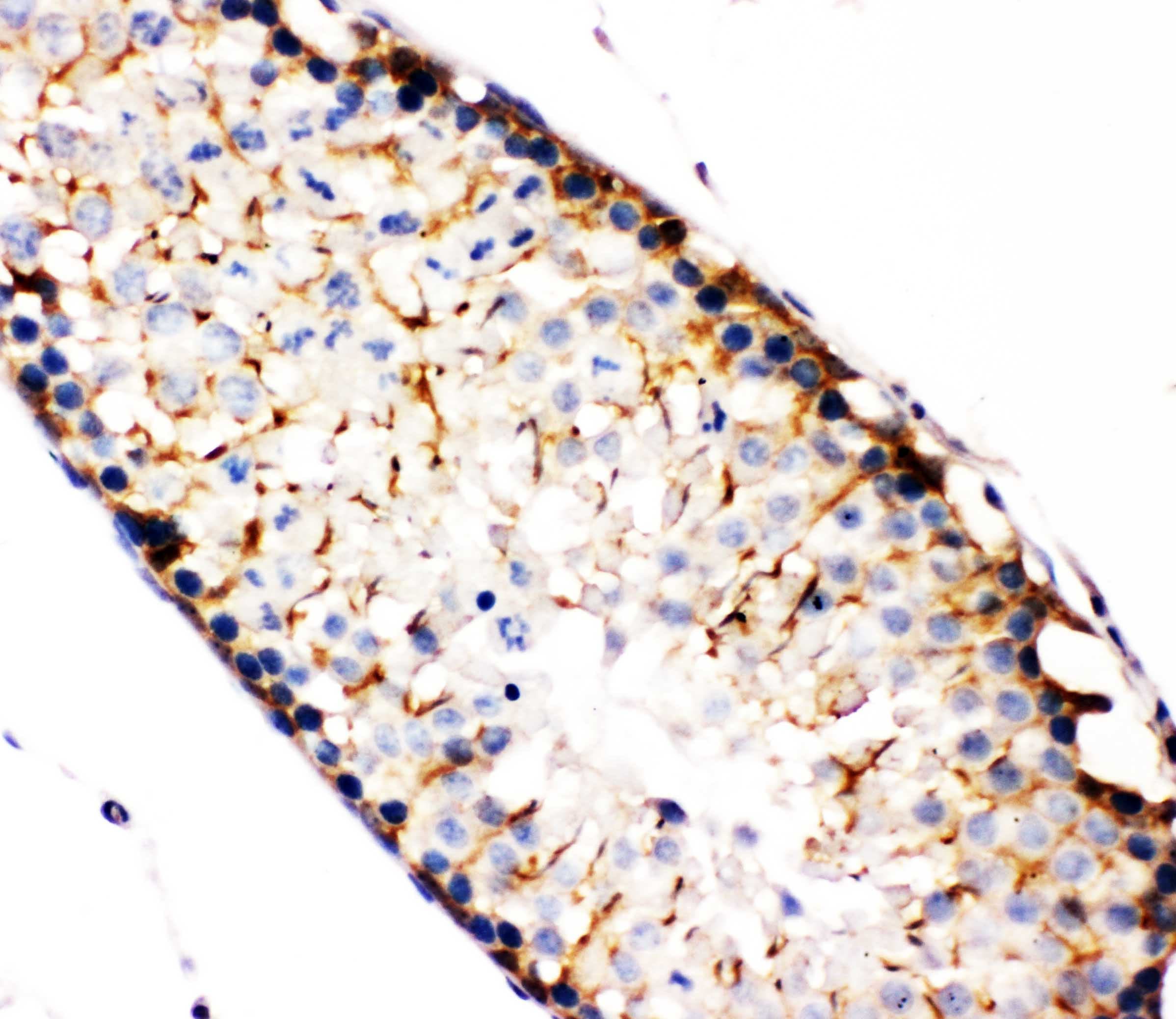 NAK / TBK1 Antibody (aa577-590)
